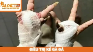 Điều trị ké gà đá
